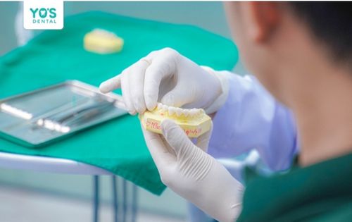 cay-ghep-implant-yos-dental-3.jpg