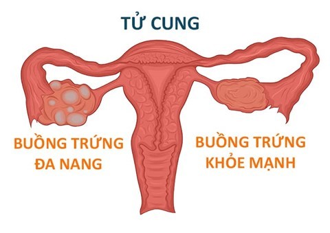 buong-trung-da-nang.jpg