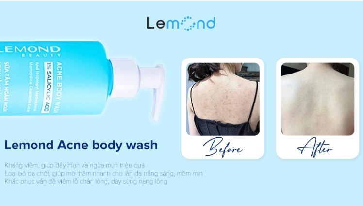acne_body_wash-4.jpg