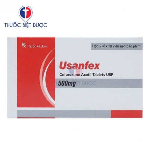 Usanfex