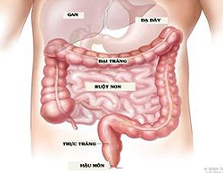 Viêm đại tràng mạn tính - Bệnh đâu chỉ của người già