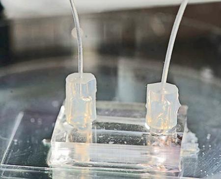 Hé lộ cách tế bào ung thư di căn trong cơ thể người