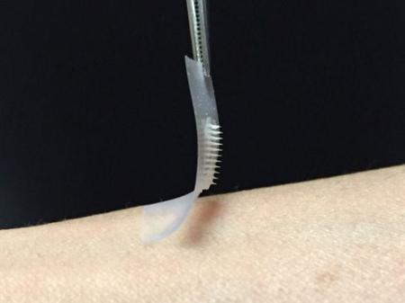 Miếng dán 'thần kỳ' cho bệnh nhân tiểu đường