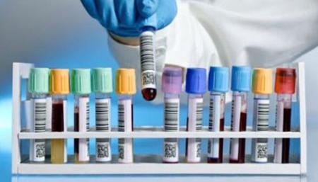 Liệu pháp thử máu mới giúp chẩn đoán ung thư