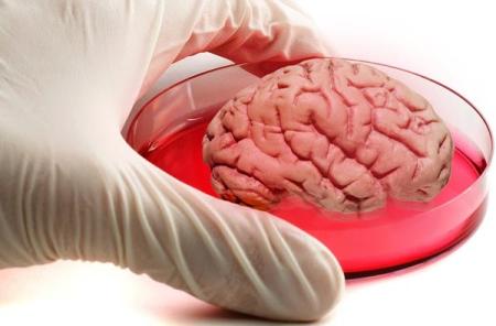 Tạo thành công não người trong phòng thí nghiệm