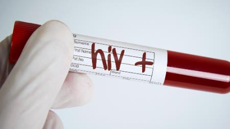 Sắp có văcxin trị HIV