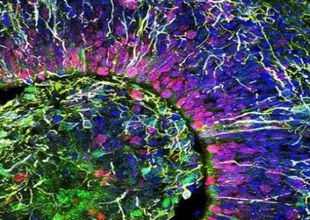 Các nhà khoa học nuôi được não nhân tạo 6 tháng tuổi, lần đầu tiên phát ra sóng não giống trẻ sơ sinh