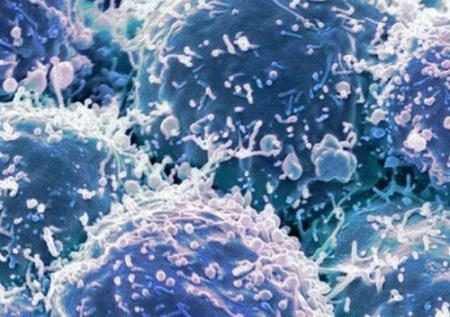 Chế tạo thành công loại virus chuyên diệt tế bào ung thư