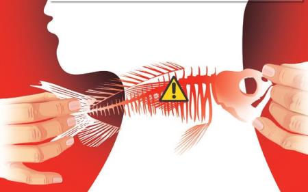 Làm gì khi bị hóc xương cá: 3 bác sĩ Singapore hướng dẫn cách xử lý đơn giản và hiệu quả
