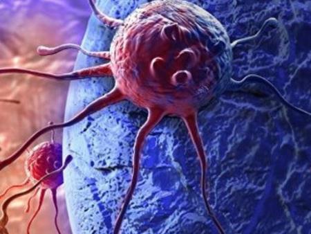 Khám phá ra phân tử tiêu diệt tế bào ung thư não tích cực nhất