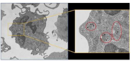 Virus có triển vọng mới trong điều trị ung thư