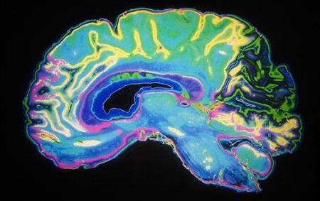 Hóa ra đây chính là “thủ phạm” khiến chúng ta cố gắng mà mãi chẳng giảm cân được