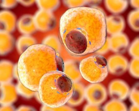 Các nhà khoa học biến thành công tế bào ung thư thành tế bào mỡ, giảm béo để chữa ung thư?