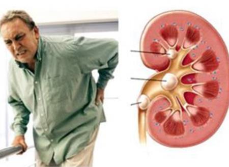 Tiểu đêm:nguyên nhân và cách điều trị