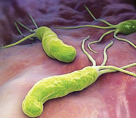 Bé 5 tuổi đã mắc bệnh từ người lớn: Chuyên gia đưa ra lời cảnh báo các cha mẹ