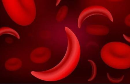 Thuốc Oxbryta (voxelotor);điều trị bệnh hồng cầu hình liềm