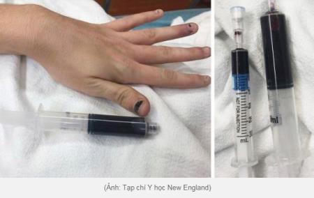 10 trường hợp y khoa kỳ lạ năm 2019