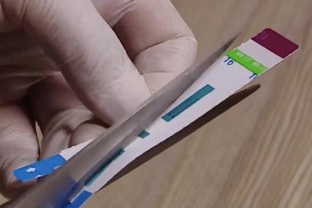 Sở Y tế sẽ thanh tra việc sử dụng que test nhanh HIV, viêm gan B tại Bệnh viện Xanh Pôn