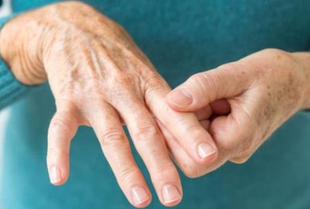 Thuốc RediTrex (methotrexate); điều trị viêm khớp và bệnh vẩy nến