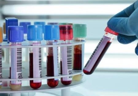 Các xét nghiệm máu quan trọng nhất