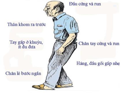 Các thuốc dùng trong điều trị Parkinson