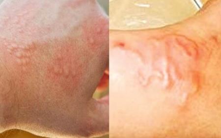 Những sai lầm về việc tẩy giun sán hầu như ai cũng mắc phải