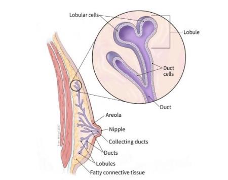 Tại sao đàn ông cũng có thể mắc ung thư vú?
