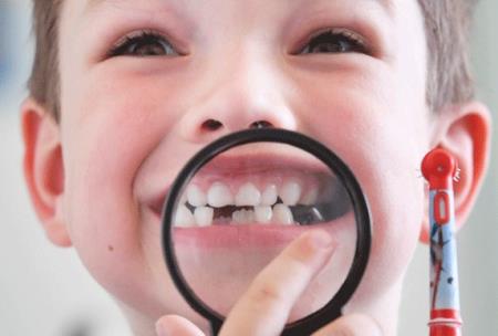 Chuyên gia chỉ ra hai nguyên nhân làm 90% người Việt mắc bệnh về răng