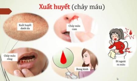 Nguy cơ bùng phát dịch sốt xuất huyết ở Hà Nội
