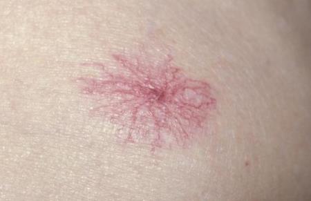 Dấu hiệu cho thấy bạn đã bị bệnh gan