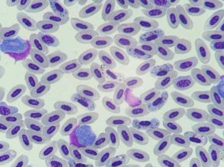 Bill Gates: "Đây là con quái vật biến hình nguy hiểm bậc nhất hành tinh"