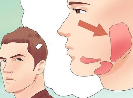 Làm sao loại bỏ nguy cơ hiếm muộn do bệnh quai bị