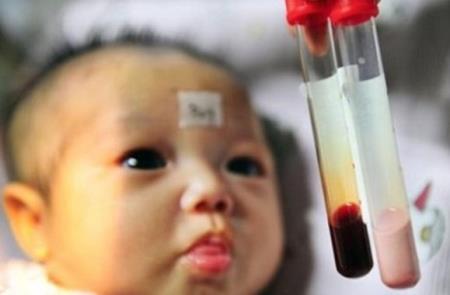 Choáng với căn bệnh tiêu tốn 2.000 tỷ mỗi năm