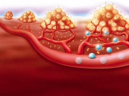 Tế bào ung thư: Những bí ẩn ít biết