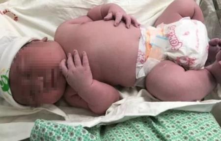 Vừa lọt lòng, bé trai đã có cân nặng ngang trẻ 3 tháng