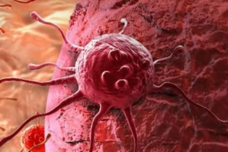 Những thực phẩm thúc đẩy tế bào ung thư: PCT Hội Ung thư HN khuyên người bệnh tránh xa