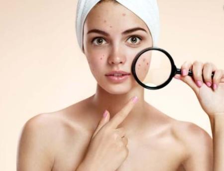 Các thuốc điều trị mụn trứng cá