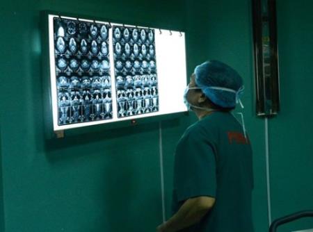 BS khuyến cáo: Xuất hiện hạch to tại vùng cổ cần cảnh giác với bệnh ung thư tuyến giáp