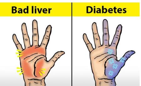 Người có chức năng gan ổn định sẽ không có 4 điểm sau trên đôi tay..
