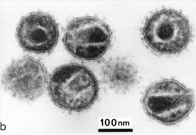 Virus đến từ đâu, chúng lây lan và gây bệnh cho chúng ta như thế nào?