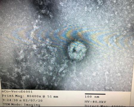 Việt Nam nuôi cấy, phân lập thành công virus corona mới