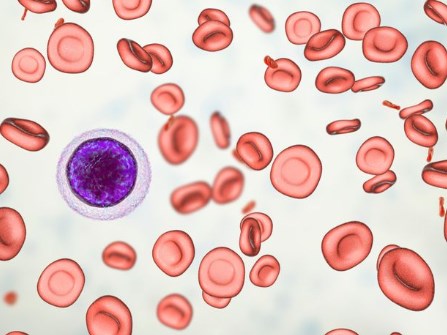 Thuốc tiêm Monoferric (ferric derisomaltose); điều trị thiếu máu do thiếu sắt được FDA chấp thuận