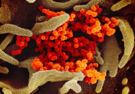 Hình ảnh rõ nét của virus Covid-19 dưới ống kính hiển vi điện tử