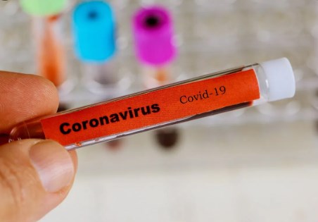 Xét nghiệm âm tính chưa thể loại trừ lây nhiễm Covid-19, còn có nhân tố gây "âm tính giả"