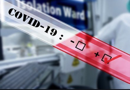 `Covid-19: Việt Nam` Ca bệnh thứ 61 mắc Covid-19 tại Ninh Thuận