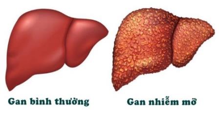 Protein ít được biết đến dường như đóng vai trò quan trọng trong bệnh béo phì và bệnh chuyển hóa
