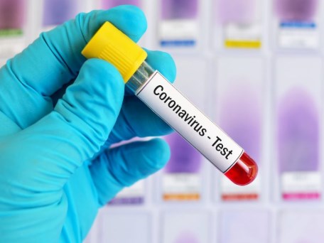 Mỹ: Đi khám vì nghi nhiễm Covid-19, sốc với viện phí 10.000 USD