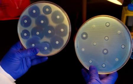 Cannabidiol giúp chống lại vi khuẩn kháng thuốc