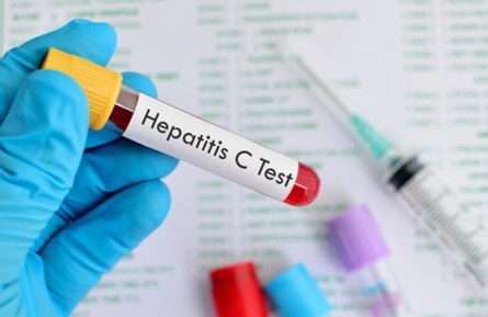 Phát hiện khi uống Aspirin liều thấp với bệnh viêm gan B, C và