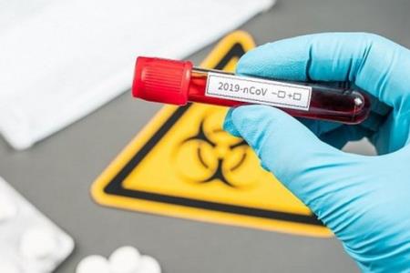 Cộng hòa Séc: Xác nhận 3 trường hợp nhiễm virus SARS-CoV-2 đầu tiên